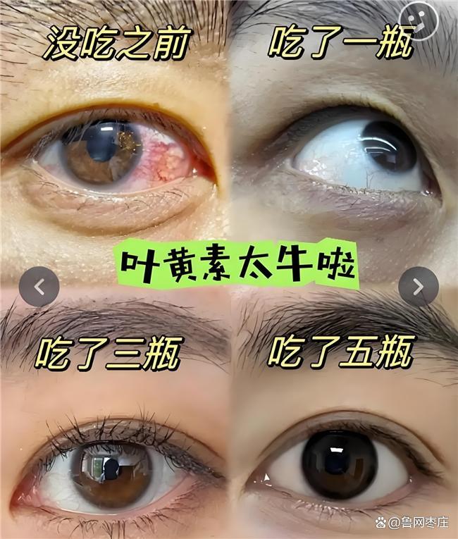 哪个品牌的叶黄素含量高？测评叶黄素十大品牌数据说话(图13)