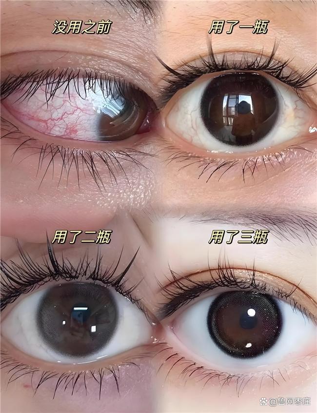 哪个品牌的叶黄素含量高？测评叶黄素十大品牌数据说话(图11)