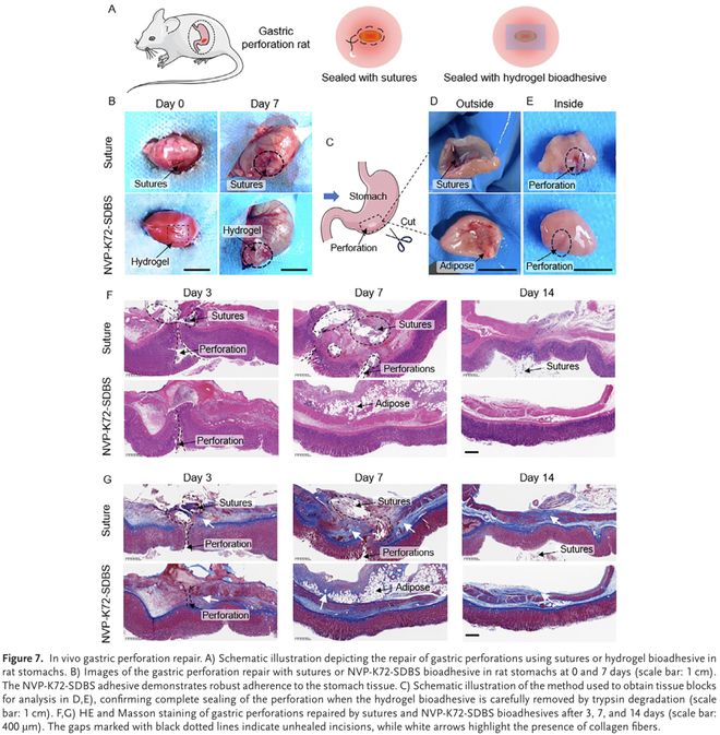 AdvMater:用于增强组织愈合的水凝胶黏合剂模块化设计(图7)